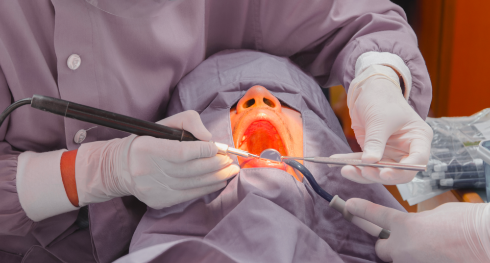patient under Conscious Sedation in irvine