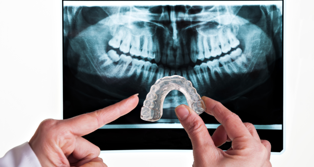 person holding an oral appliance to treat sleep apnea