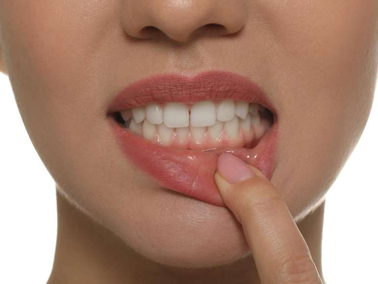 close up of patient pointing to teeth and lips